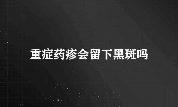 重症药疹会留下黑斑吗