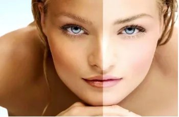 做一次激光美白一般要多少钱一次