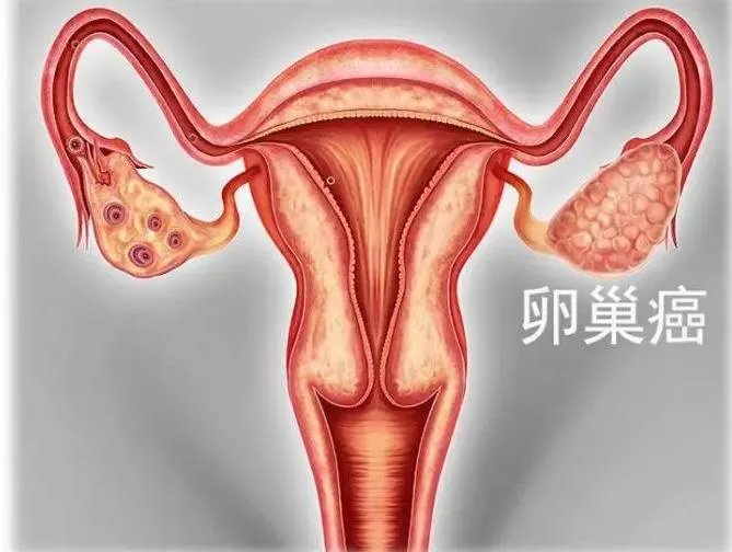 有偿帮生孩子-互助献血成有偿兼职 揭秘新“血头”“赚钱术”