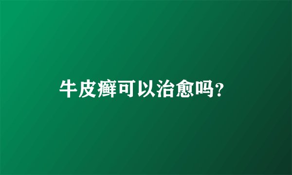 牛皮癣可以治愈吗？