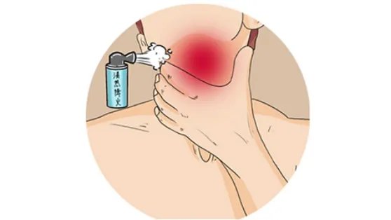 上火吃什么食物可以降火