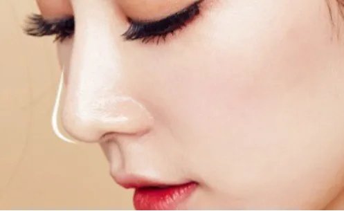 郑州假体隆鼻哪家好