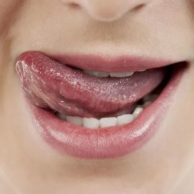 经常口腔溃疡怎么办