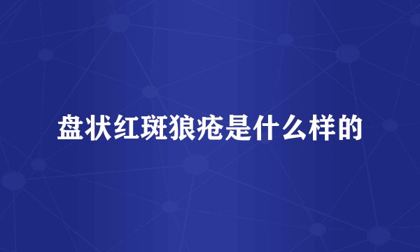 盘状红斑狼疮是什么样的