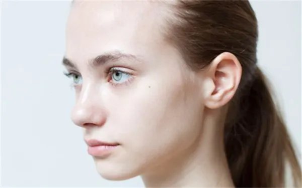 怎么祛斑最有效