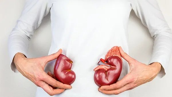 肾结石的治疗方法