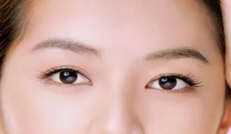 广州眼部手术医院哪里比较好