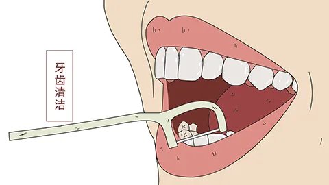牙线是什么