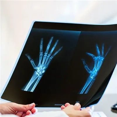 手腕扭伤怎么办