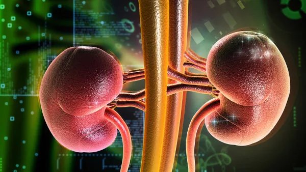 肾结石的治疗方法