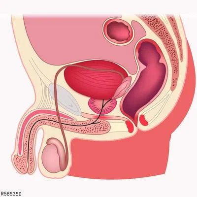 包皮炎会出现哪些症状表现