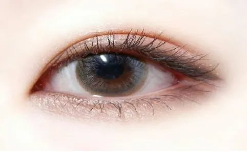 双眼皮整形有什么效果