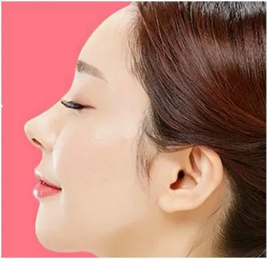 脸部松弛怎么办