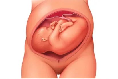 胎位横位真实肚子图片