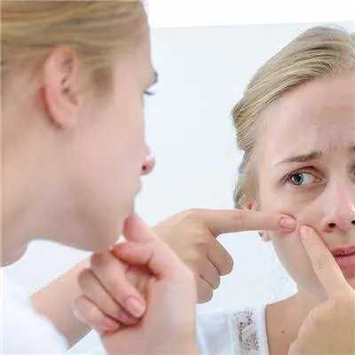 去痘方法有哪些