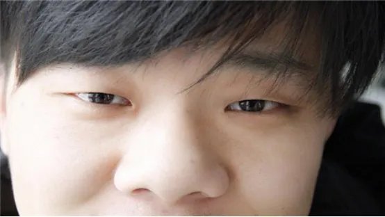 视神经损伤怎么治疗