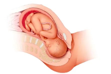 胎位横位真实肚子图片