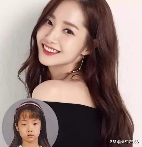 割双眼皮到底好不好？