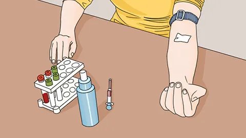 羊癫疯会传染吗