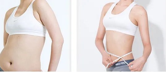 做抽脂手术多少钱