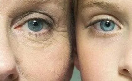 脸上皱纹多怎么办呢