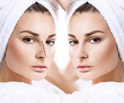 鼻子整形怎么做的 看看几种常见的鼻子整形手术