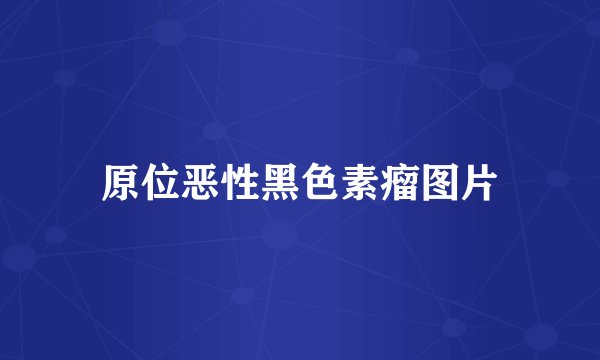 原位恶性黑色素瘤图片