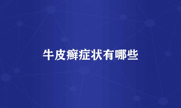 牛皮癣症状有哪些