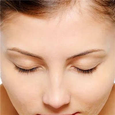 脸上毛孔很大怎么回事