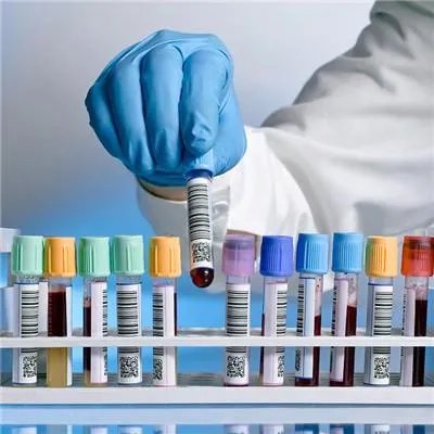 尿毒症怎么治疗