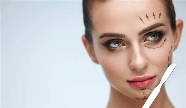 鼻唇沟除皱术适合吗