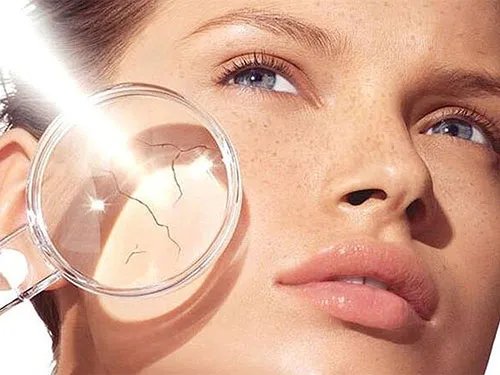 晒伤后怎么处理 皮肤晒伤了怎么修复