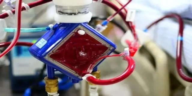 ecmo费用多少钱一天