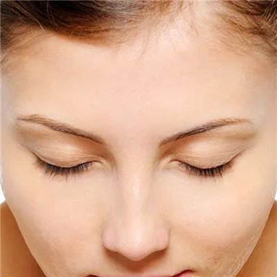 脸上痘印怎么去