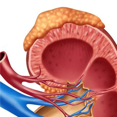 肾病症状有哪些?
