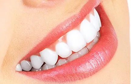 种植牙一颗大概多少钱