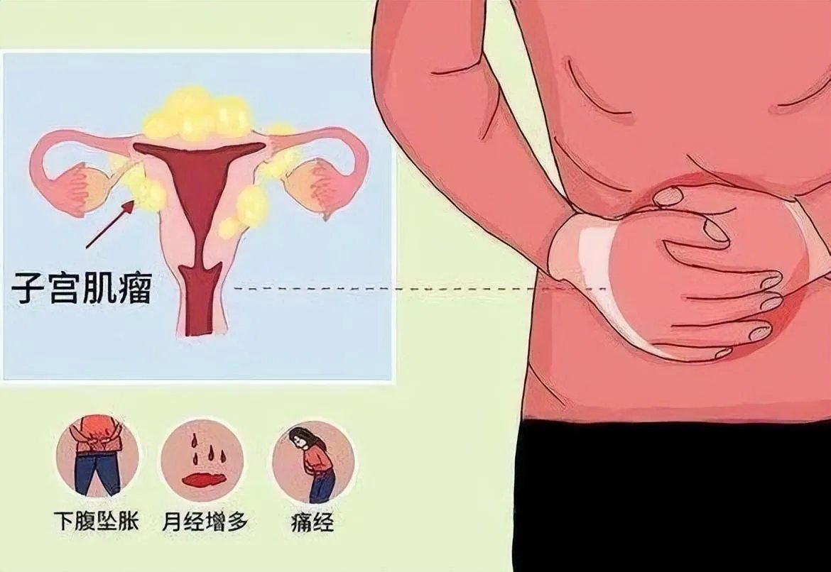 国内能供应卵子的公立三甲医院-汨罗不孕不育最好的生殖医院在哪里？