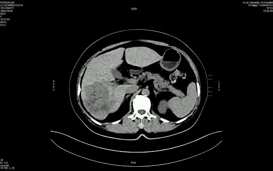 怎样把医学胶片图像拍清晰