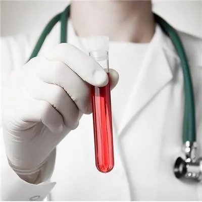 血尿酸高的原因有哪些