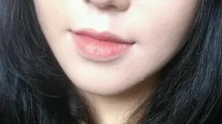 打下巴玻尿酸多少钱