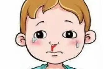 河南通报儿童流鼻血，目前医生的诊断结果是什么？