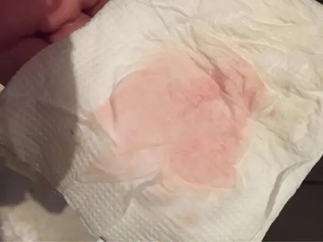 为什么有姐妹说试管移植后粉红色好事？