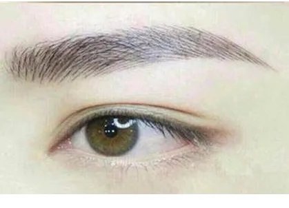 眼部吸脂安全吗